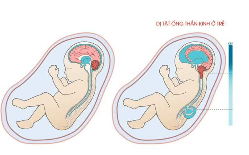 Thành phần Natabiol Plus Omega 3 chứa sát và acid folic